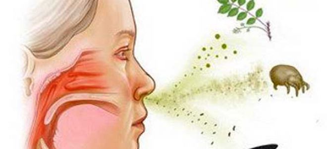 Аллергический кашель — причины и лечение